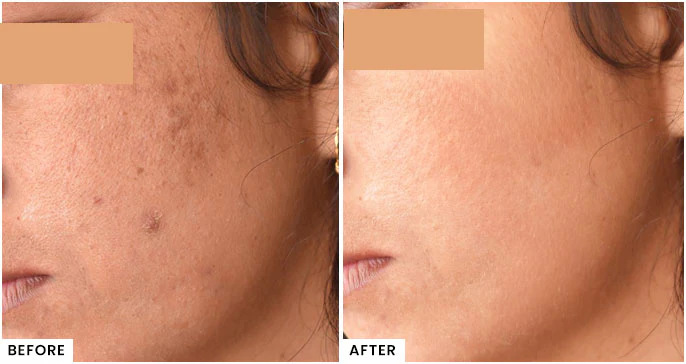 Sunscreen expected results